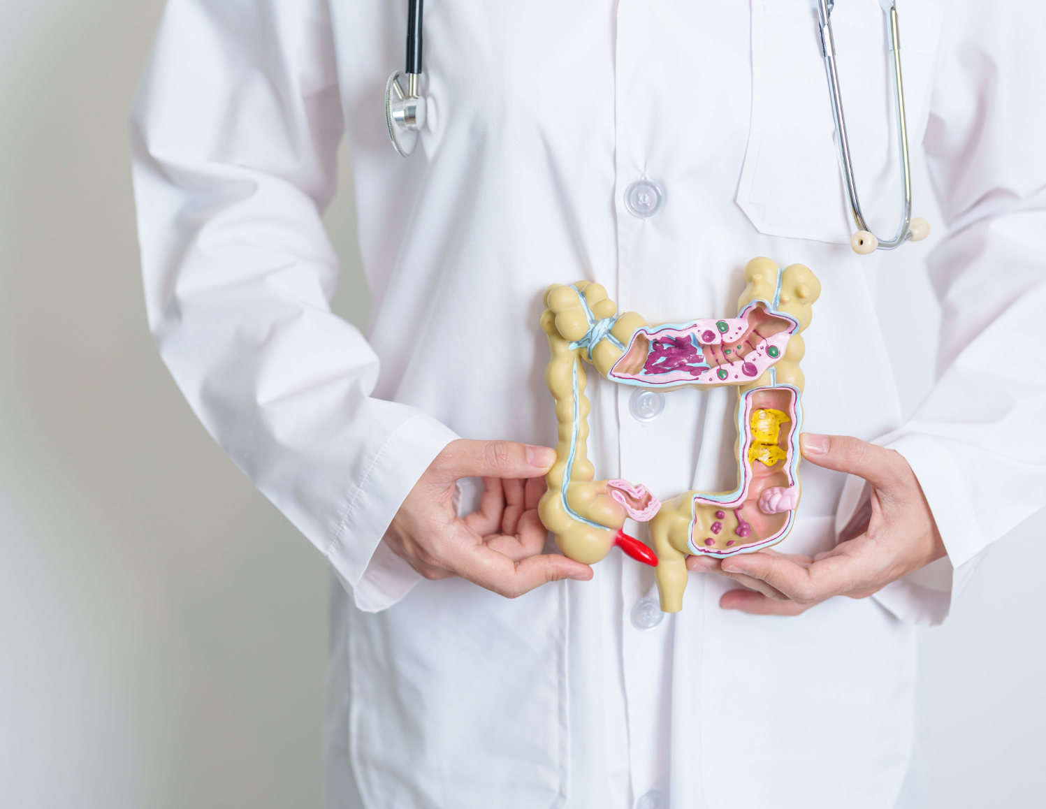 Un medecin tient une maquette d'intestin devant son ventre